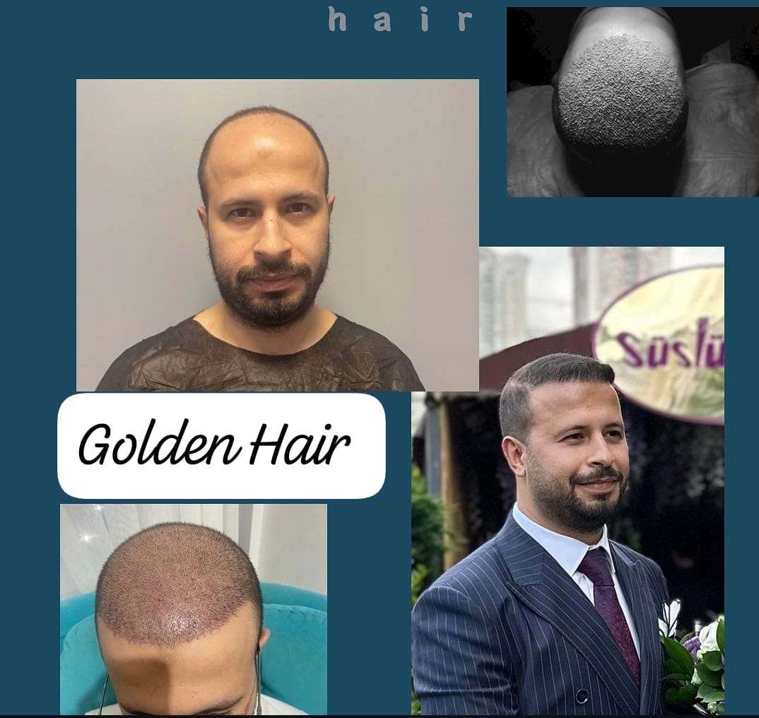 WhatsApp Image 2025-08-12 à 14.50.39_0dbf3cd1