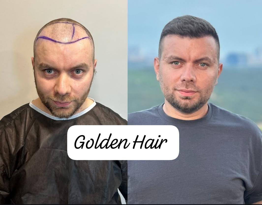 WhatsApp Image 2025-08-12 à 14.50.40_a117113e