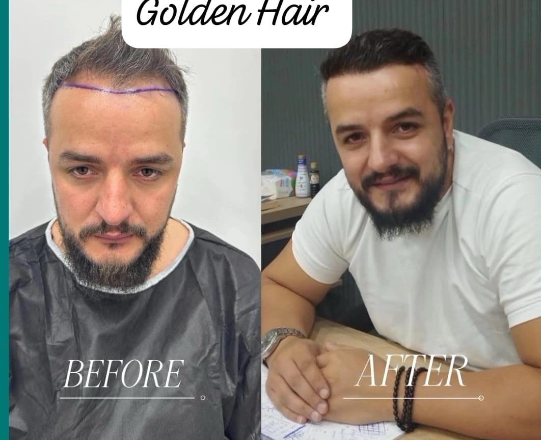 WhatsApp Image 2025-08-12 à 14.50.40_f77266b2